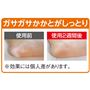 ガサガサかかとがしっとり