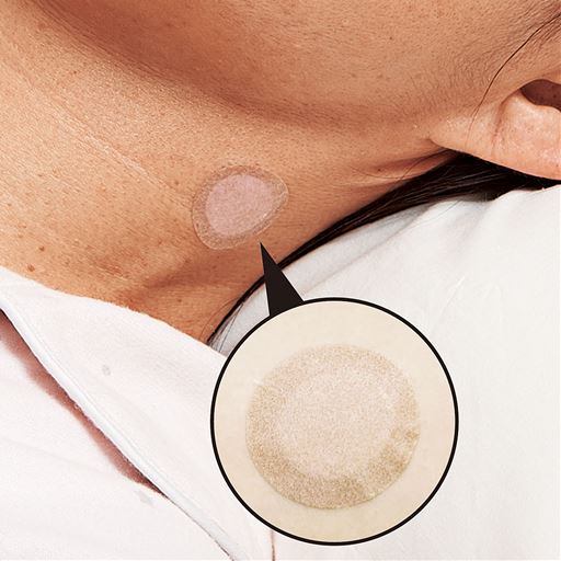 固定シール付き