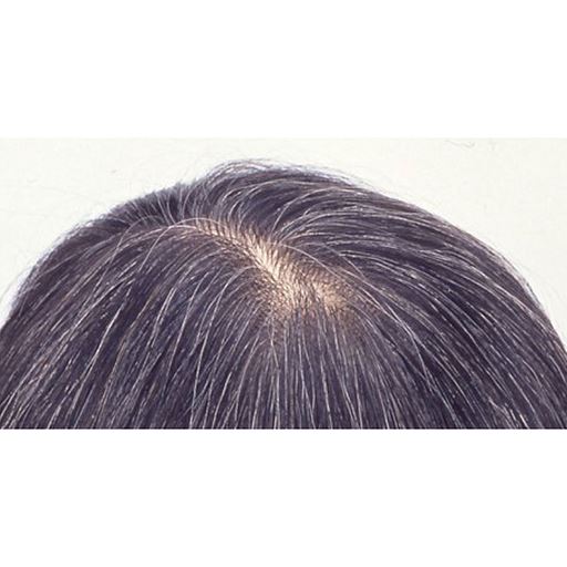 地肌の透け・根元の白毛・トップのボリューム不足に!