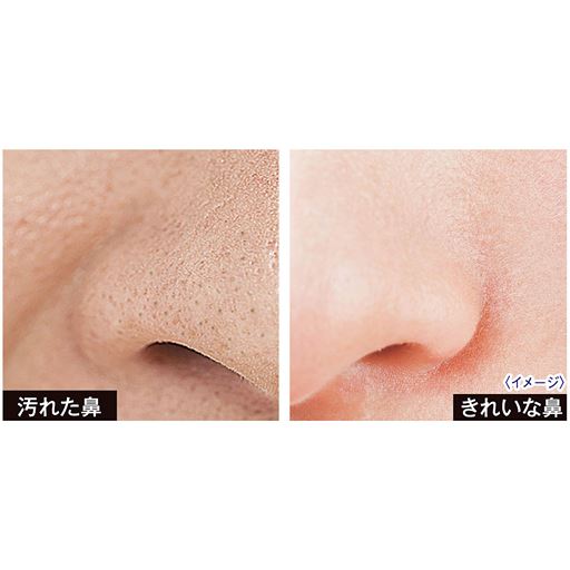 こんなに印象が違う!左:汚れた鼻、右:きれいな鼻<br>※イメージ <br>※同一人物ではありません。