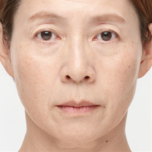 使用例<br>※皮膚形成による物理的効果(塗布時の一時的効果)<br>※仕上がりには個人差があります。