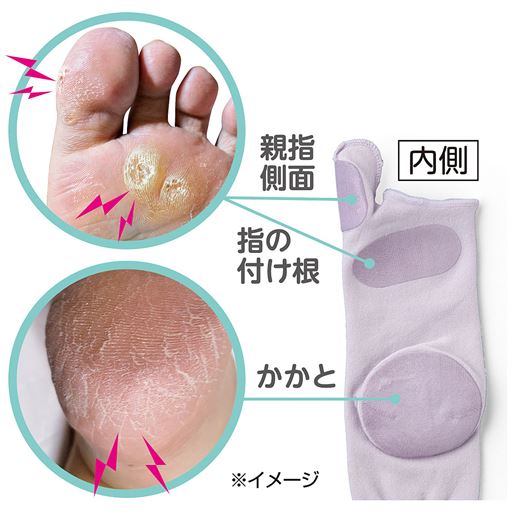 3点ケア!気になるガサガサをシリコンで集中保湿