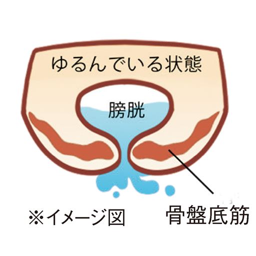 しっかり持ち上げることでお悩みや不安を軽減!骨盤底筋まわりがゆるんでいる状態