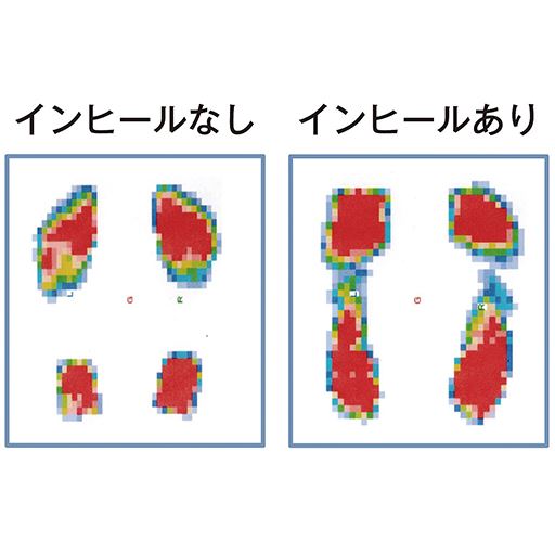 重心の安定感で姿勢もサポート 足裏全体で歩きやすい