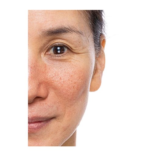 メイク前 <br>見せたくない年齢サイン