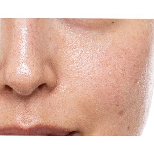 毛穴、シミ「、くすみ、小ジワ 大人の肌悩み…