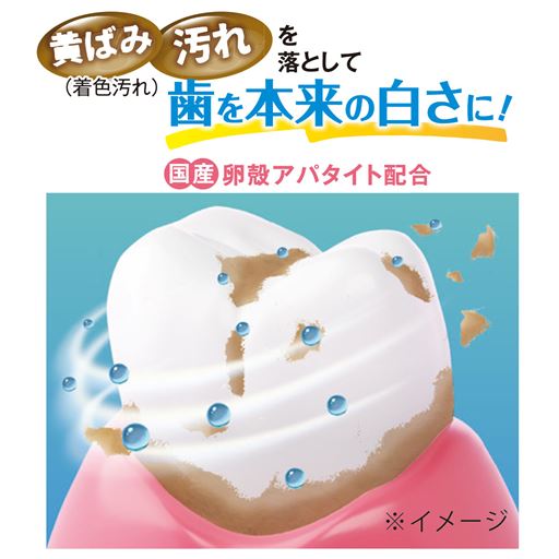 黄ばみ(着色汚れ)・汚れを落として、歯を本来の白さに!