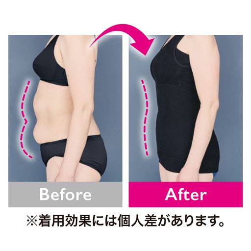 着用前・着用後の比較写真<br>※効果には個人差があります。