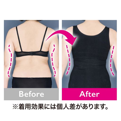 着用前・着用後の比較写真<br>※効果には個人差があります。