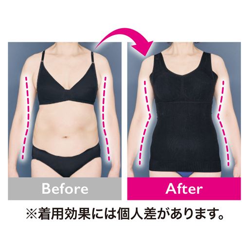 着用前・着用後の比較写真<br>※効果には個人差があります。