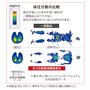 【体圧分散の比較】<br>一般製品と圧力分散軽減機能衣類の比較。