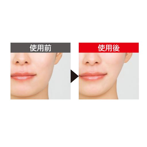 EMS(※1)ですっきりフェイスを目指す <br>※メーカー調べ。 結果には個人差があり、効果を保証するものではありません。 <br>※本品を10分間使用した一時的な効果です。※モニター3名中1名のデータ。