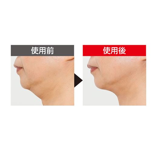 EMS(※1)ですっきりフェイスを目指す <br>※メーカー調べ。 結果には個人差があり、効果を保証するものではありません。 <br>※本品を10分間使用した一時的な効果です。※モニター3名中1名のデータ。