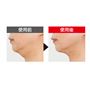 EMS(※1)ですっきりフェイスを目指す <br>※メーカー調べ。 結果には個人差があり、効果を保証するものではありません。 <br>※本品を10分間使用した一時的な効果です。※モニター3名中1名のデータ。