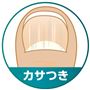 ～その悩み菌が原因かも～<br>カサつき<br>※イメージ