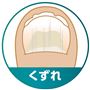 ～その悩み菌が原因かも～<br>くずれ<br>※イメージ