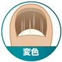 ～その悩み菌が原因かも～<br>変色<br>※イメージ