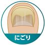 ～その悩み菌が原因かも～<br>にごり<br>※イメージ