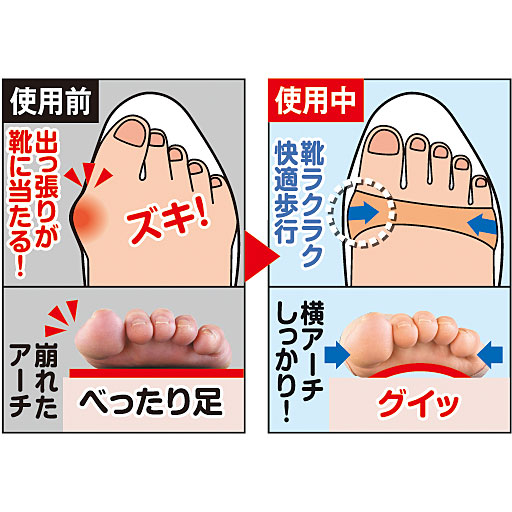 外反母趾アーチグイット セシール Cecile