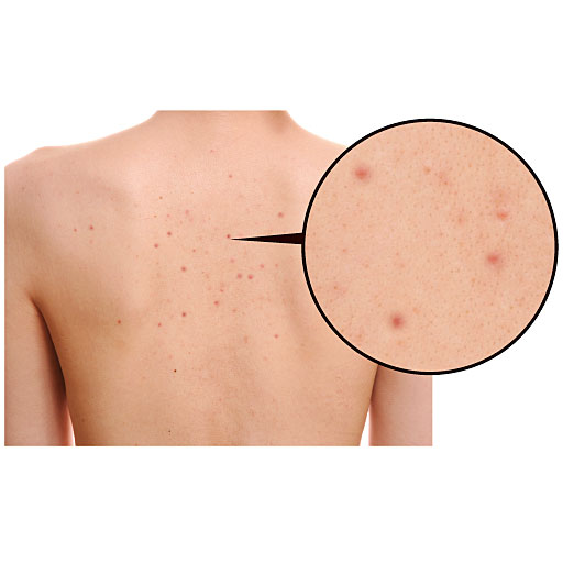 ツルピカ背中 にゃんこセラピスト セシール Cecile