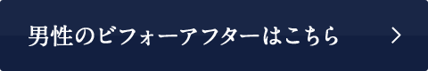 男性のビフォーアフターはこちら